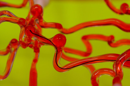 Científicos del MIT crean robots con forma de hilo para facilitar el acceso a los vasos sanguíneos del cerebro