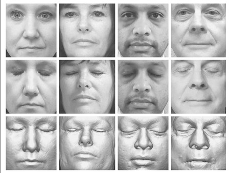 El reconocimiento facial de resonancias magnéticas amenaza el anonimato de participantes en estudios médicos según la Clínica Mayo